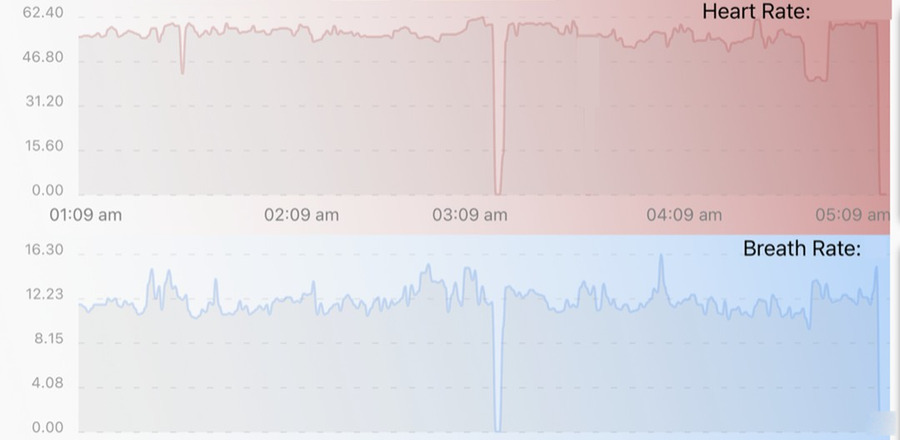The Cardi/o® app history screen showing four hours from one room, heart rate plotted above and breath rate below, from one in the morning to five in the morning